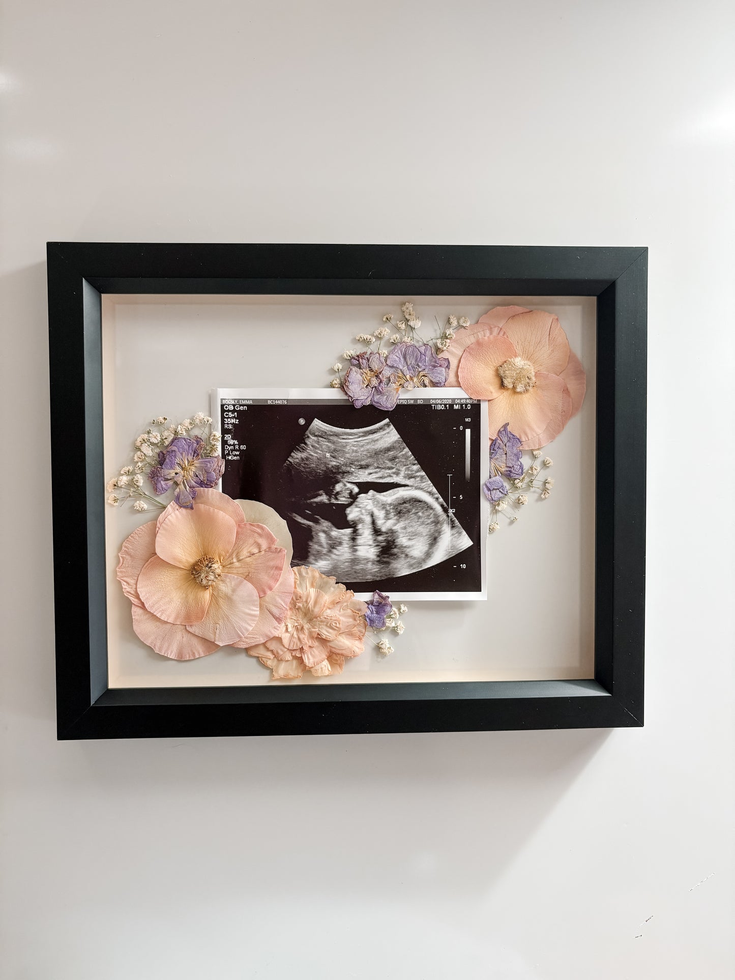 Sonogram