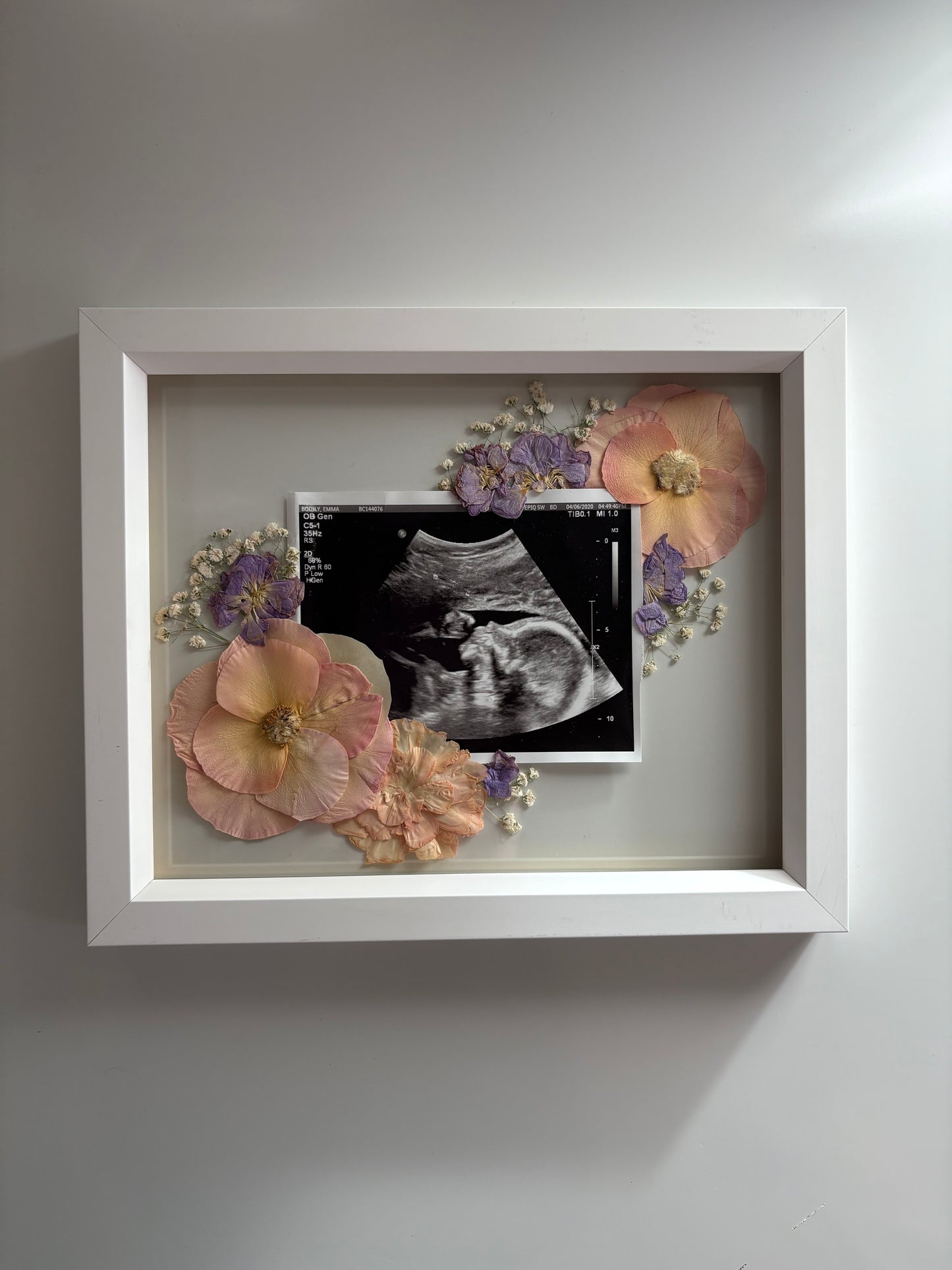 Sonogram