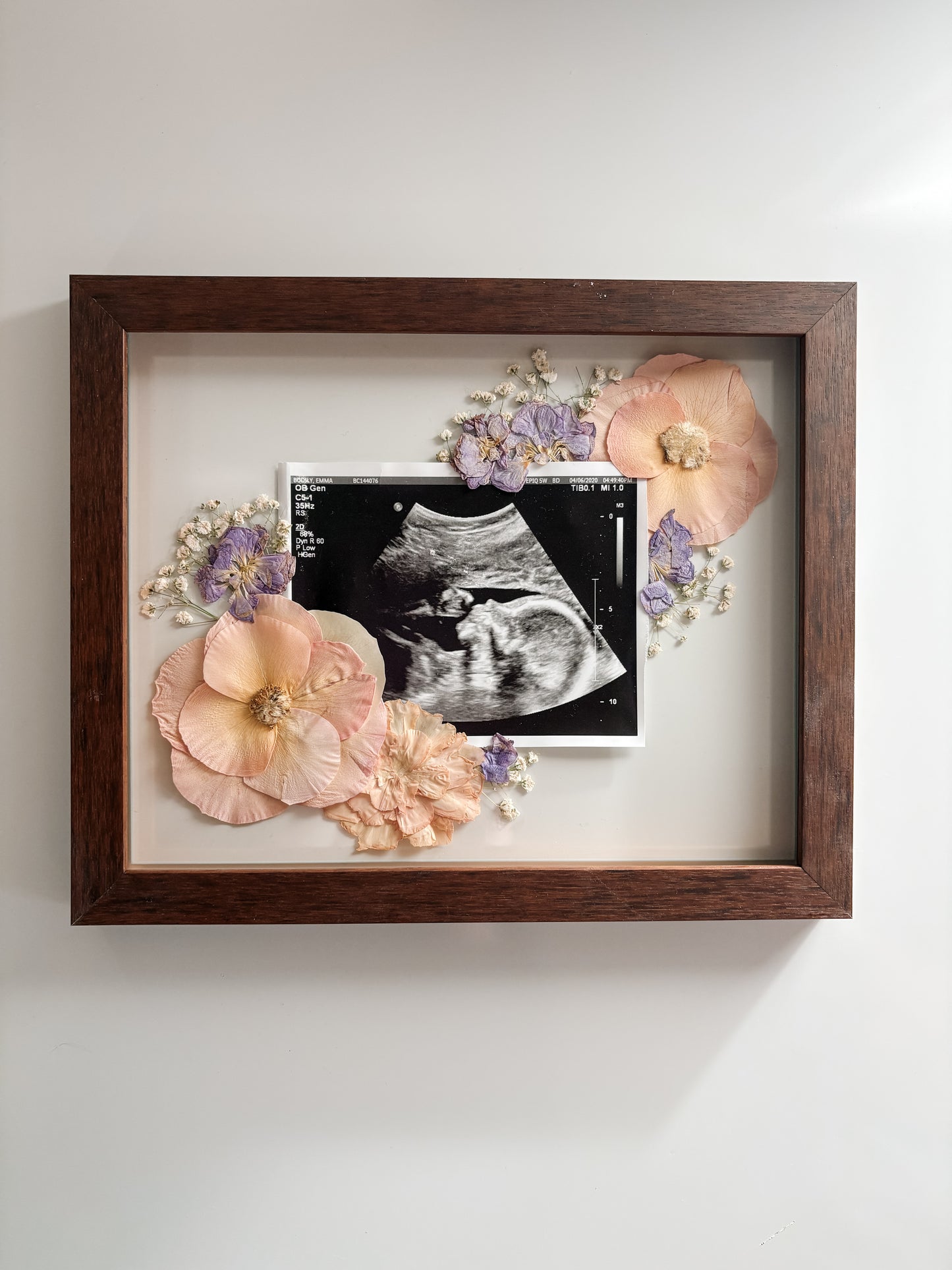 Sonogram
