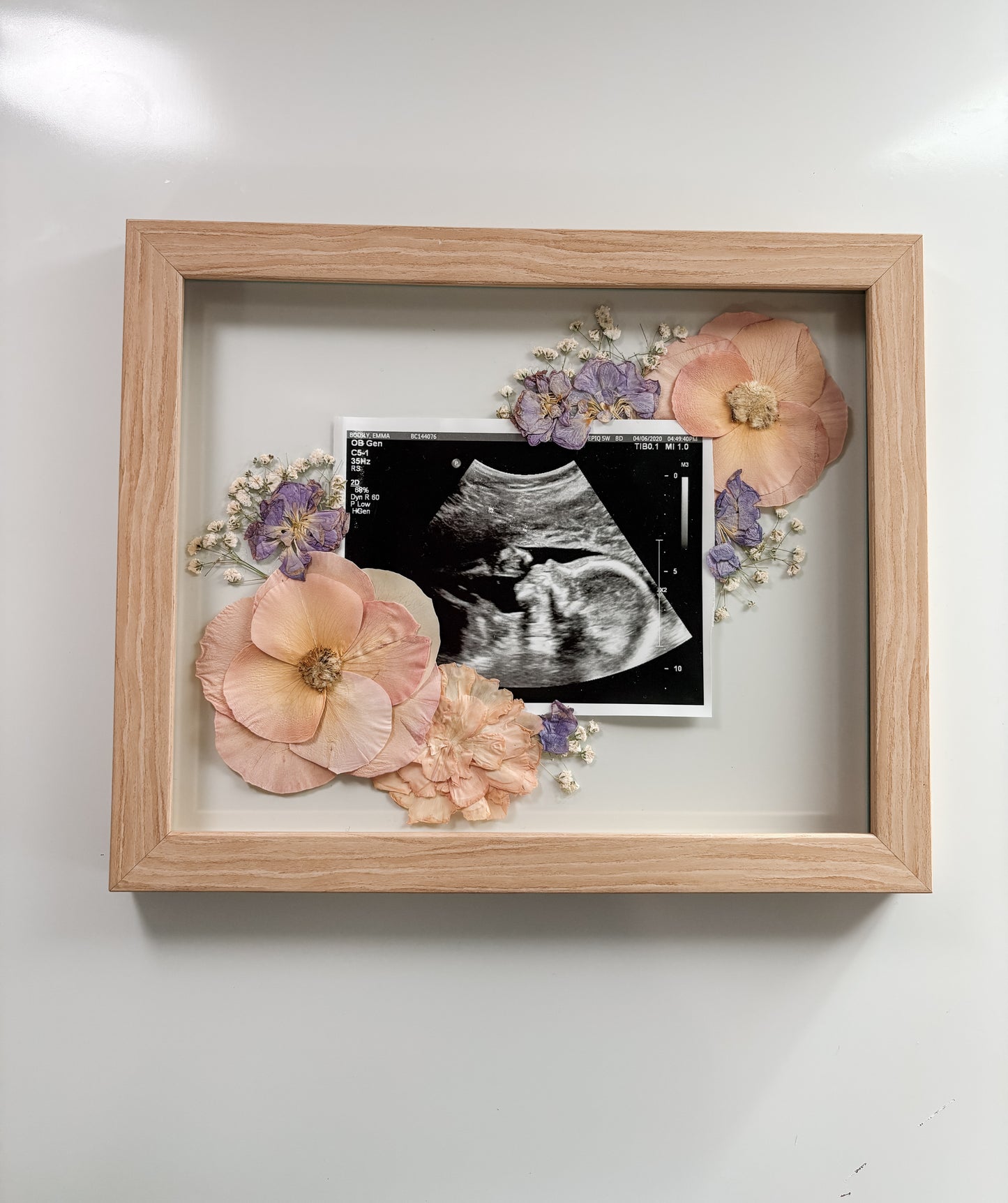 Sonogram